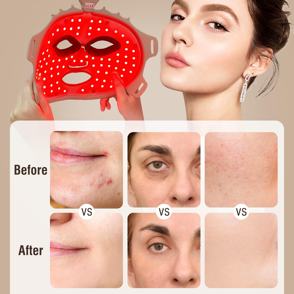 Angauss eye-protection shields help block light during treatment.