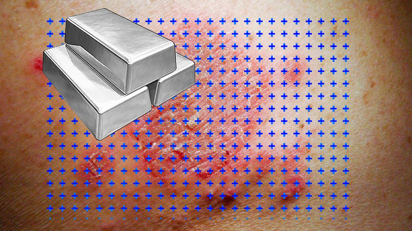 Angels Lab Colloidal Silver Gel after sun exposure for soothing care.