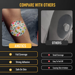 ANGTICS Dexcom G7 hypoallergenic adhesive patch for sensitive skin.