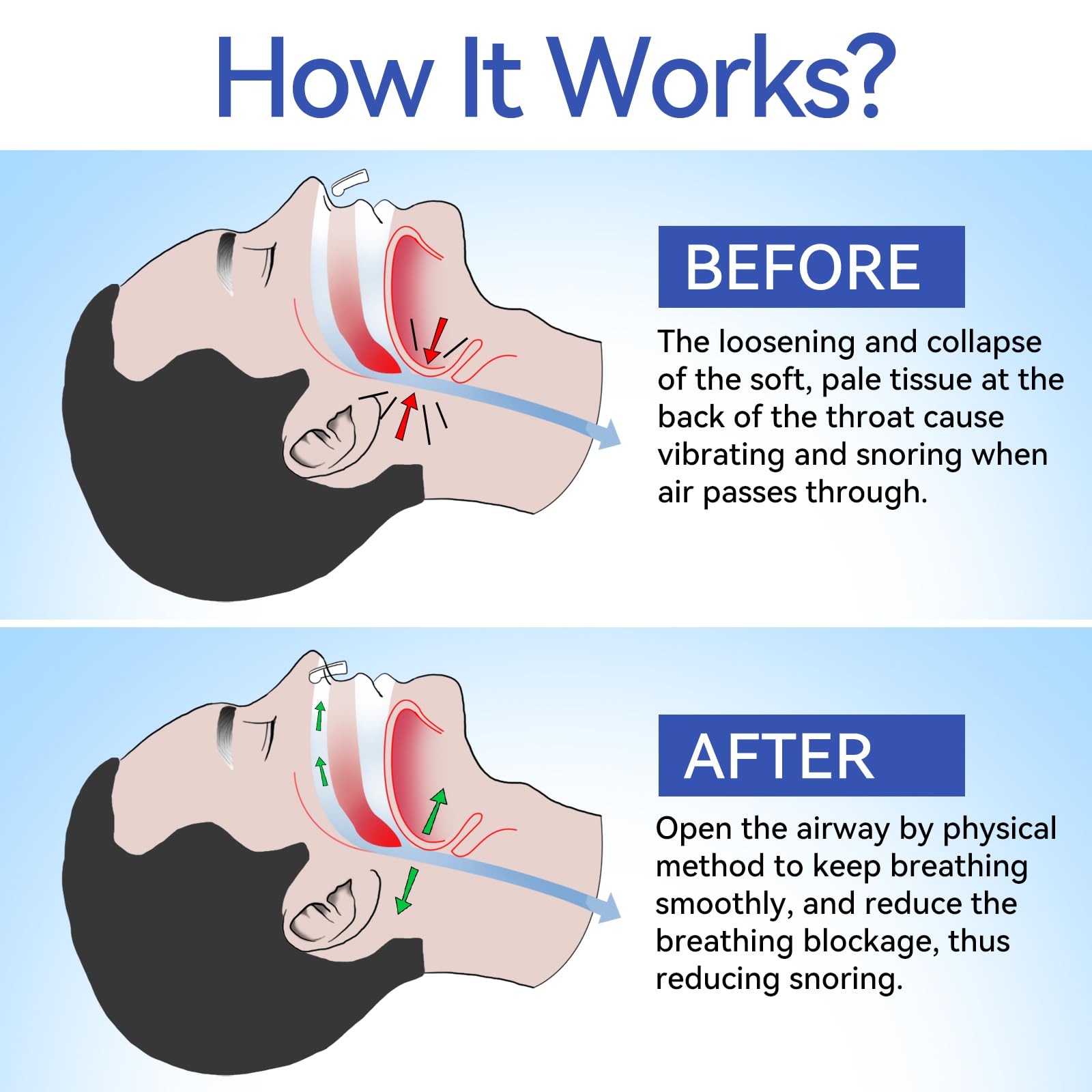 Anngola snoring device aids nasal breathing for potentially quieter nights