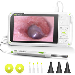 Anykit digital otoscope with 4-inch screen for at-home ear viewing