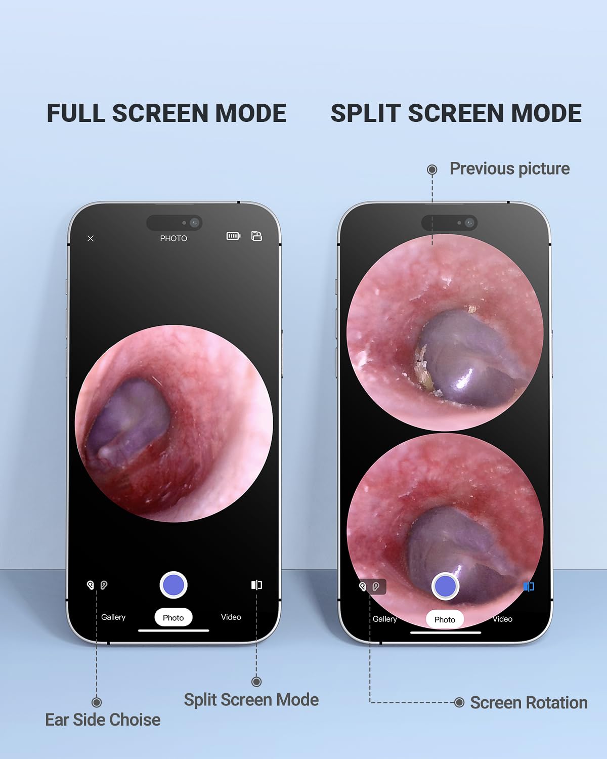 Capture and share ear images to your doctor quickly.