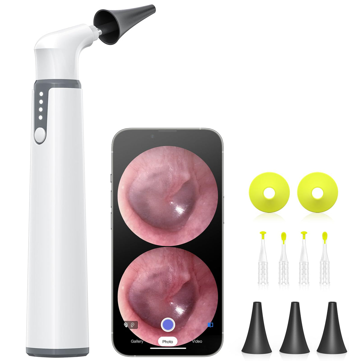 AnyScope wireless otoscope with gyroscope provides stable orientation for clear ear canal visuals.