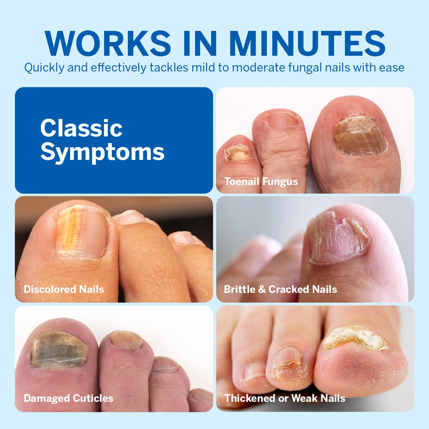 Before and after nails treated with Ariella renewal formula.