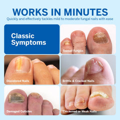 Before and after nails treated with Ariella renewal formula.