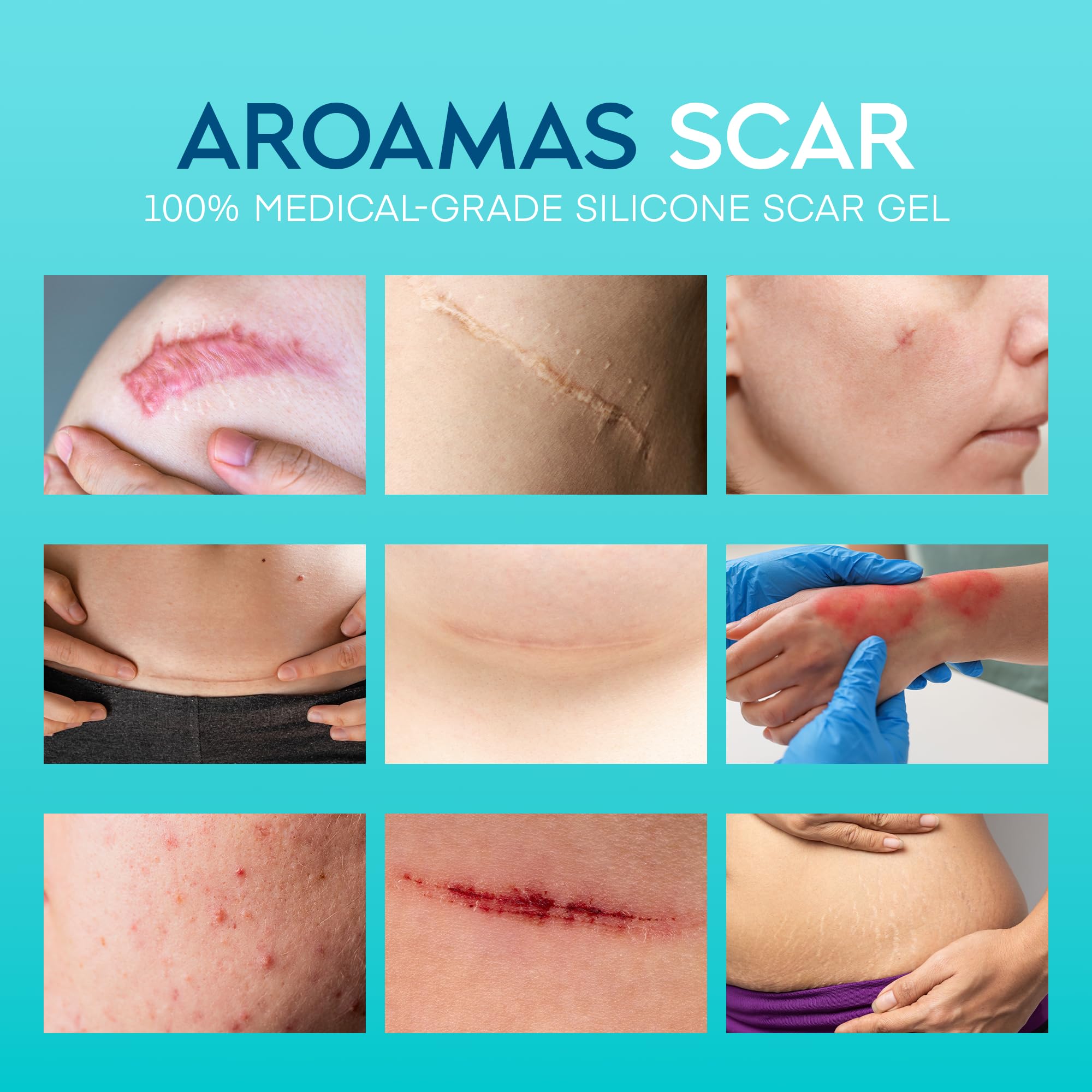 Aroamas Scar Gel being applied to skin for scar appearance improvement