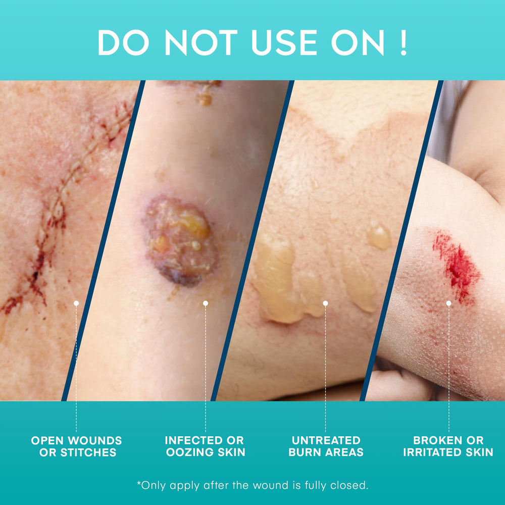 Spread of gel during application on forearm