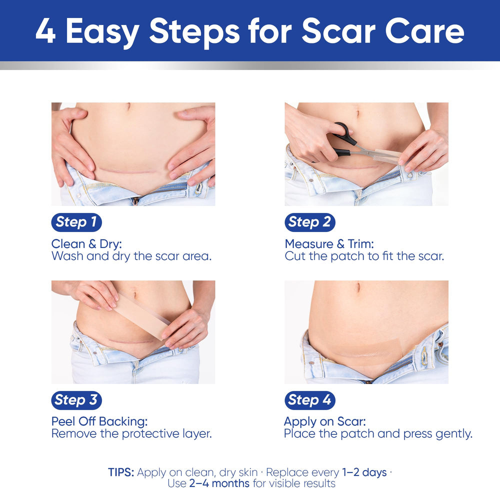 Aroamas Scar tape suitable for face and body as part of daily routine