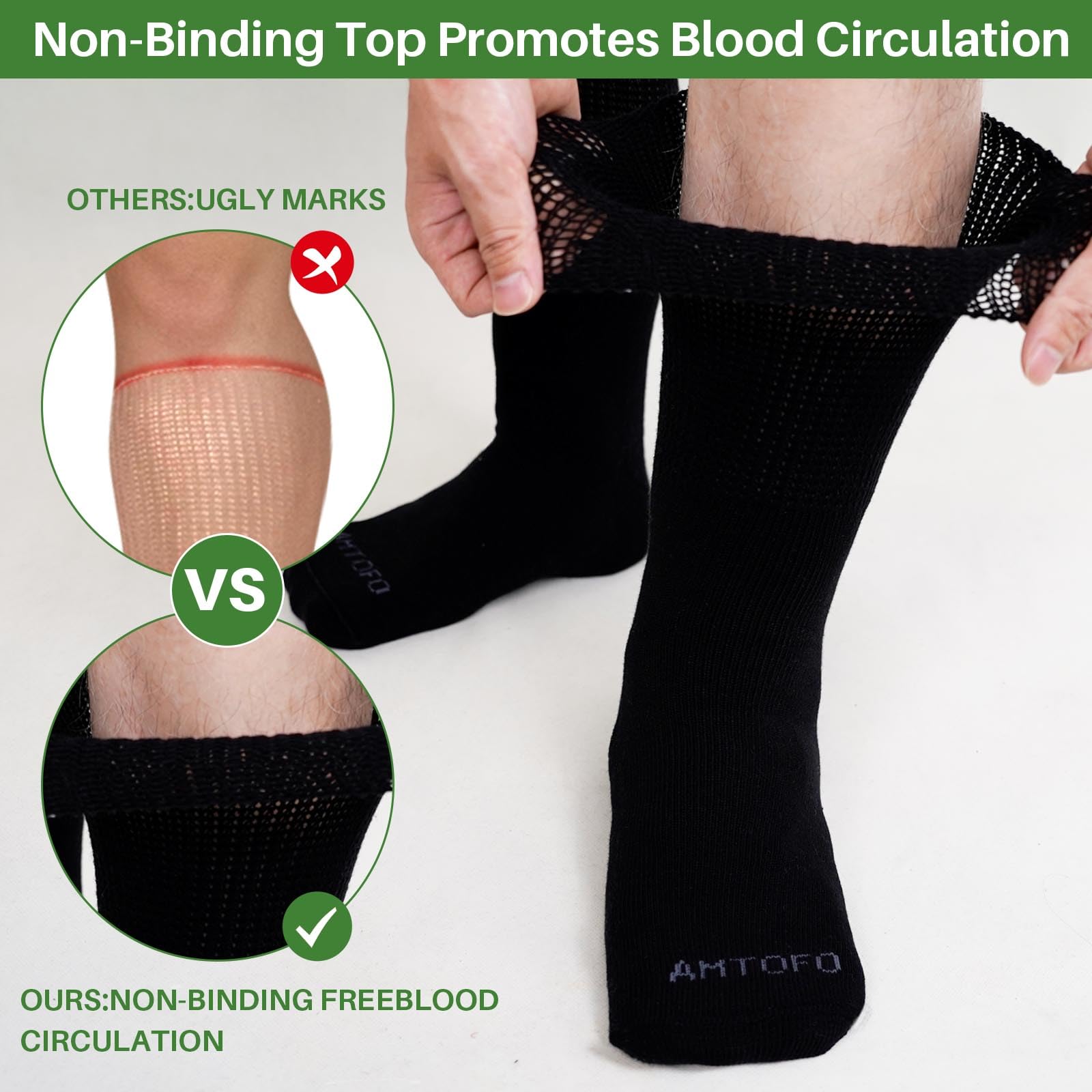 Artfasion diabetic hospital cast socks on foot demonstrating easy wear over casts.