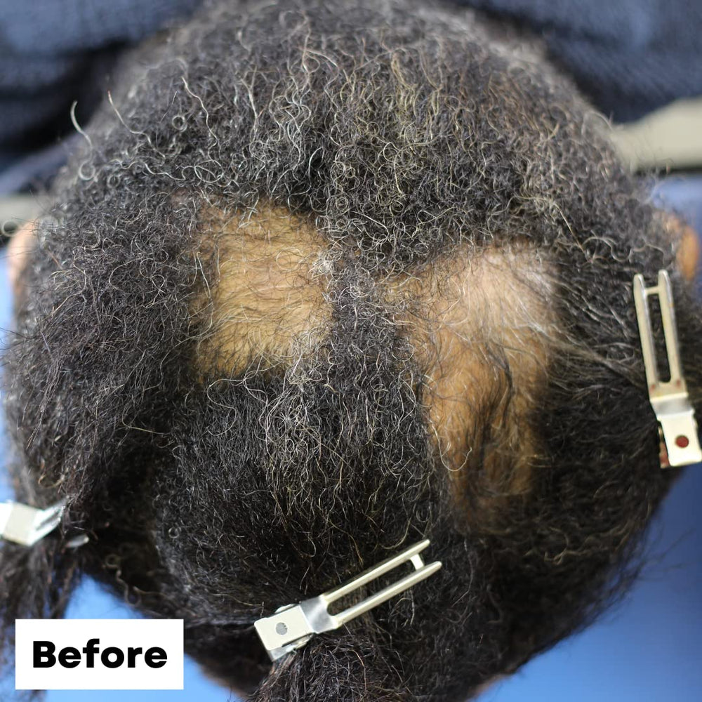 As I Am Biotin Saw Palmetto Ceramide blend detail for healthier-looking hair