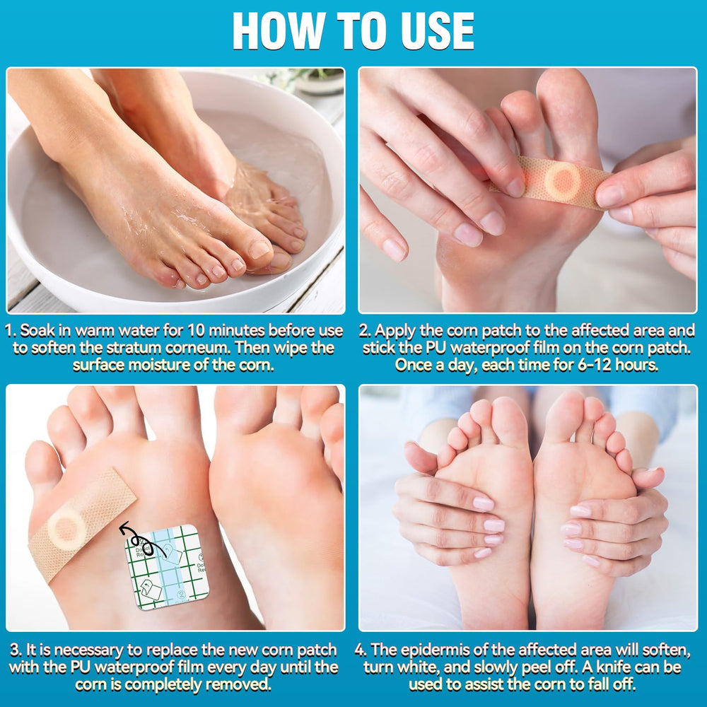 AstraVox easy-to-use corn remover kit for simple daily application