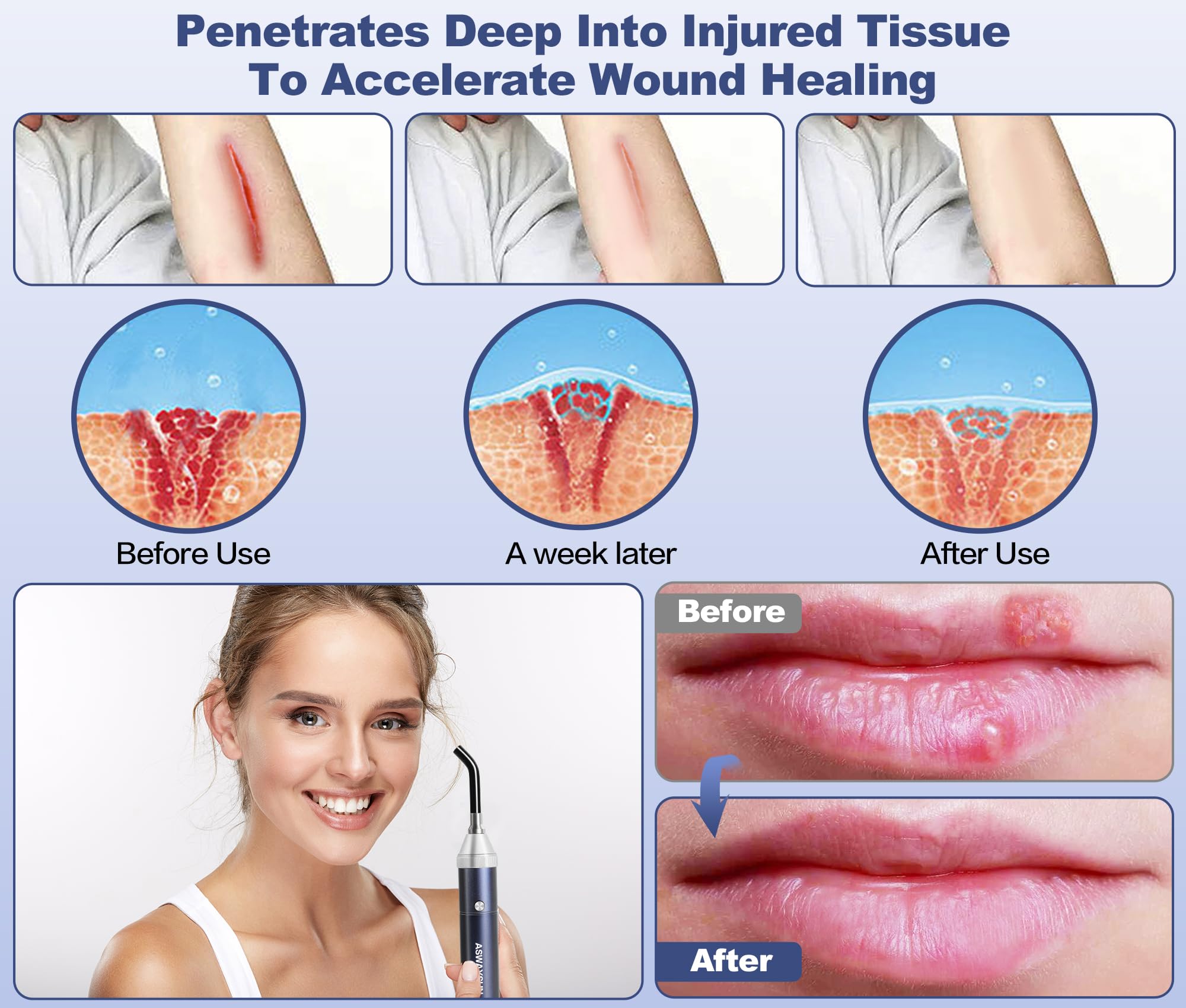 Aswaysun facial tip targets sensitive areas like face and nose.