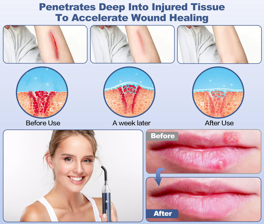 Aswaysun facial tip targets sensitive areas like face and nose.