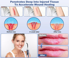 Aswaysun facial tip targets sensitive areas like face and nose.