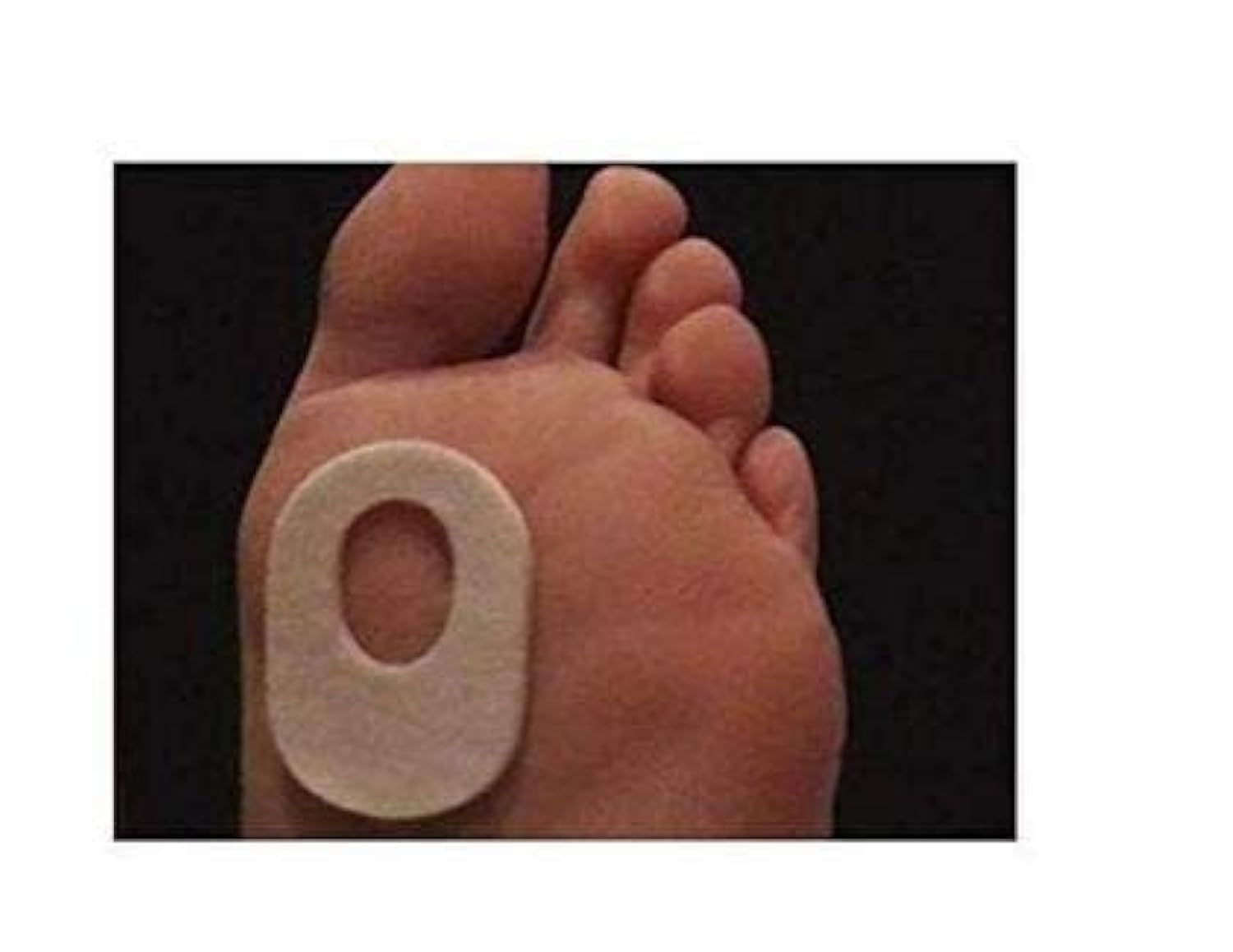 Atlas Biomechanics Callus Pad shown in use as bunion pad to ease pressure