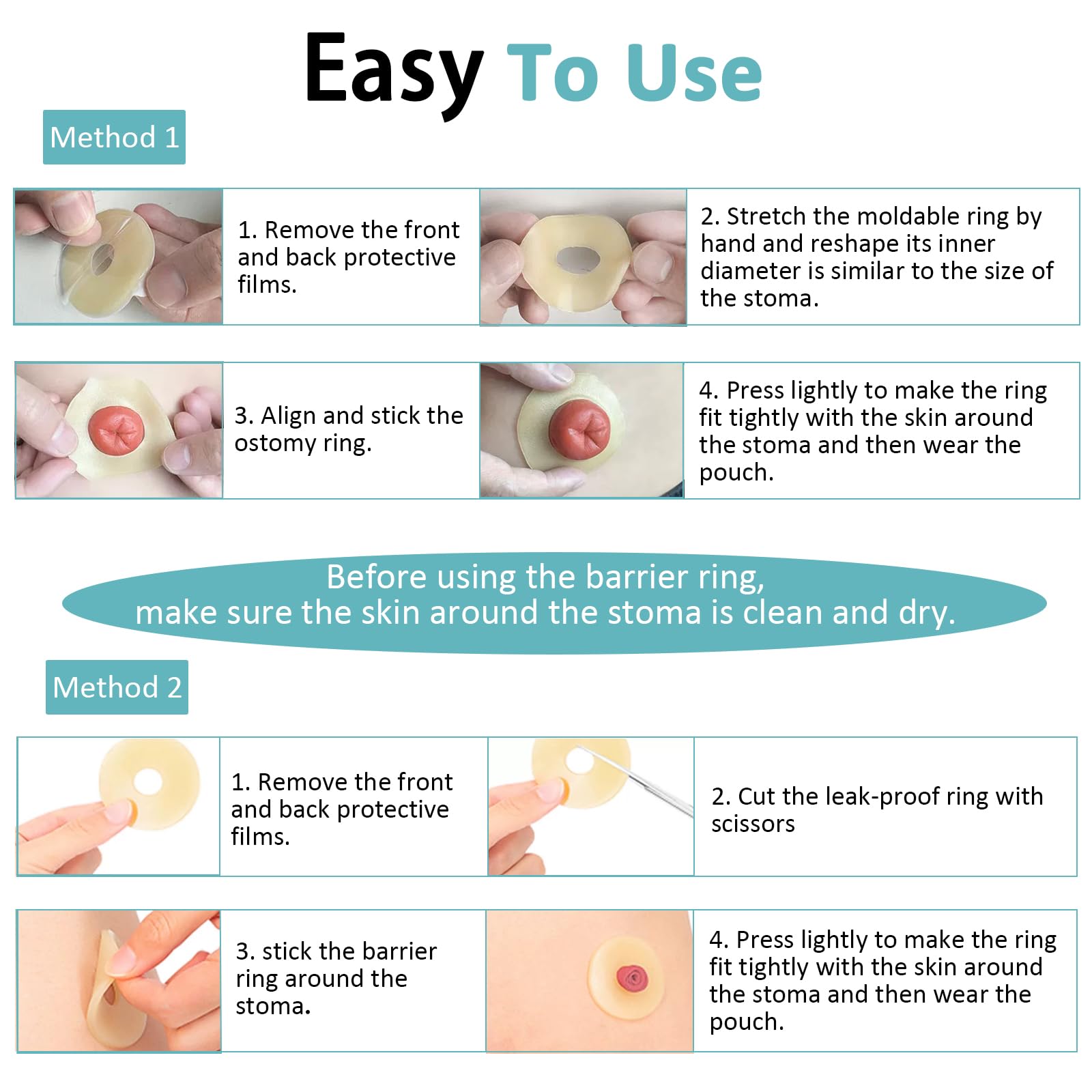 Atwlux ostomy barrier rings with 50mm diameter for secure sealing