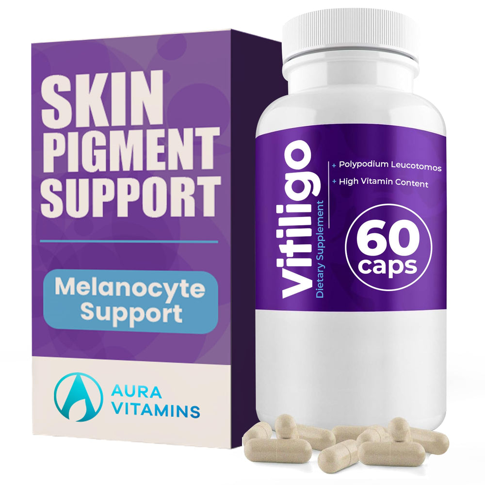Aura Vitamins Vitiligo Capsules bottle front, convenient daily pigmentation support.