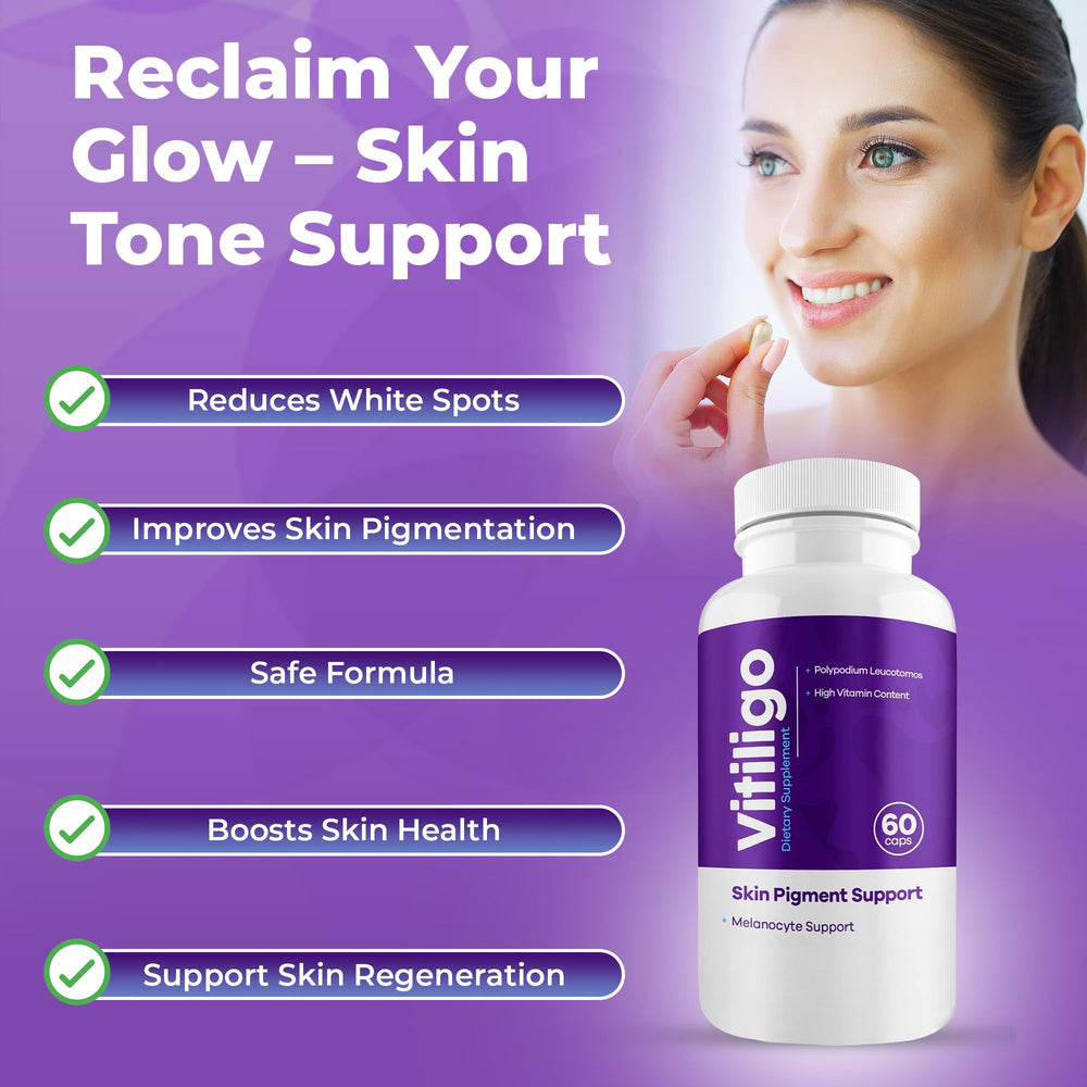 Aura Vitamins Vitiligo Capsules box close-up highlighting premium blend.