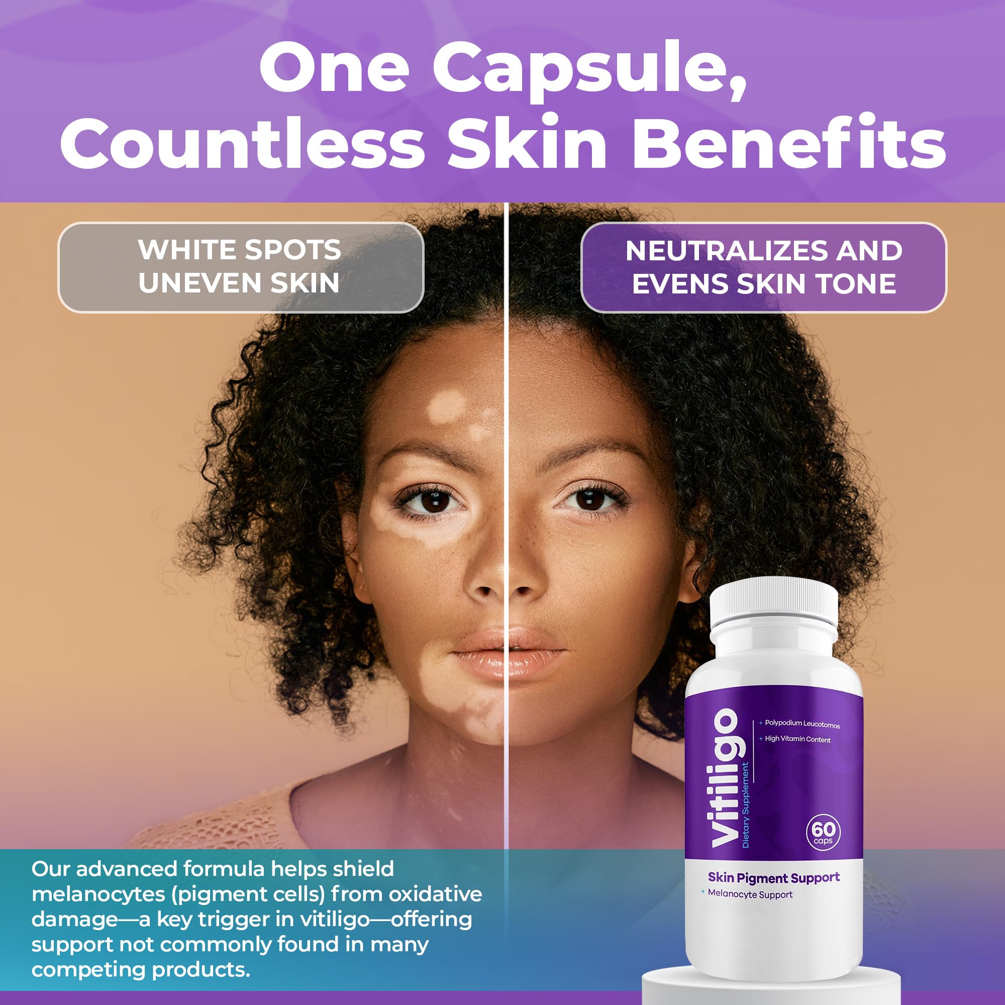 Aura Vitamins Vitiligo Capsules GMP facility seal emphasizes quality control.