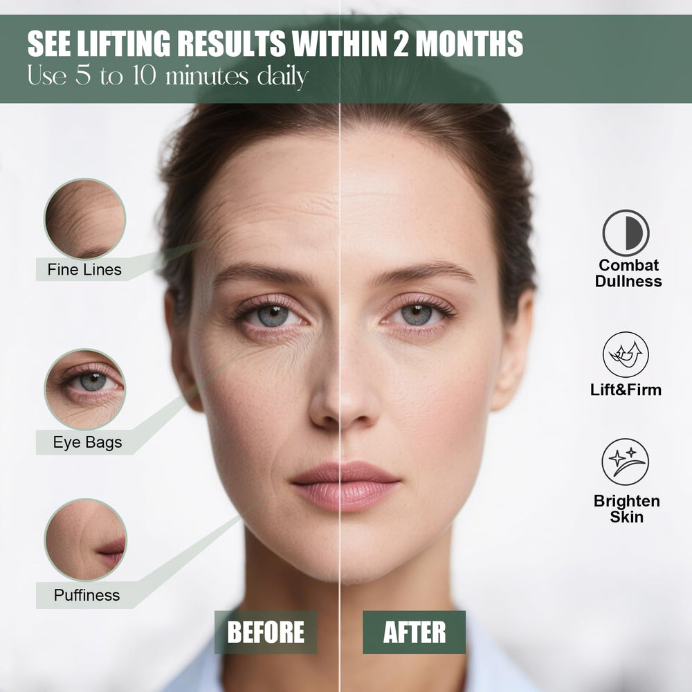 AVALEBETI jaw lift area demonstrating contouring and lymphatic drainage potential