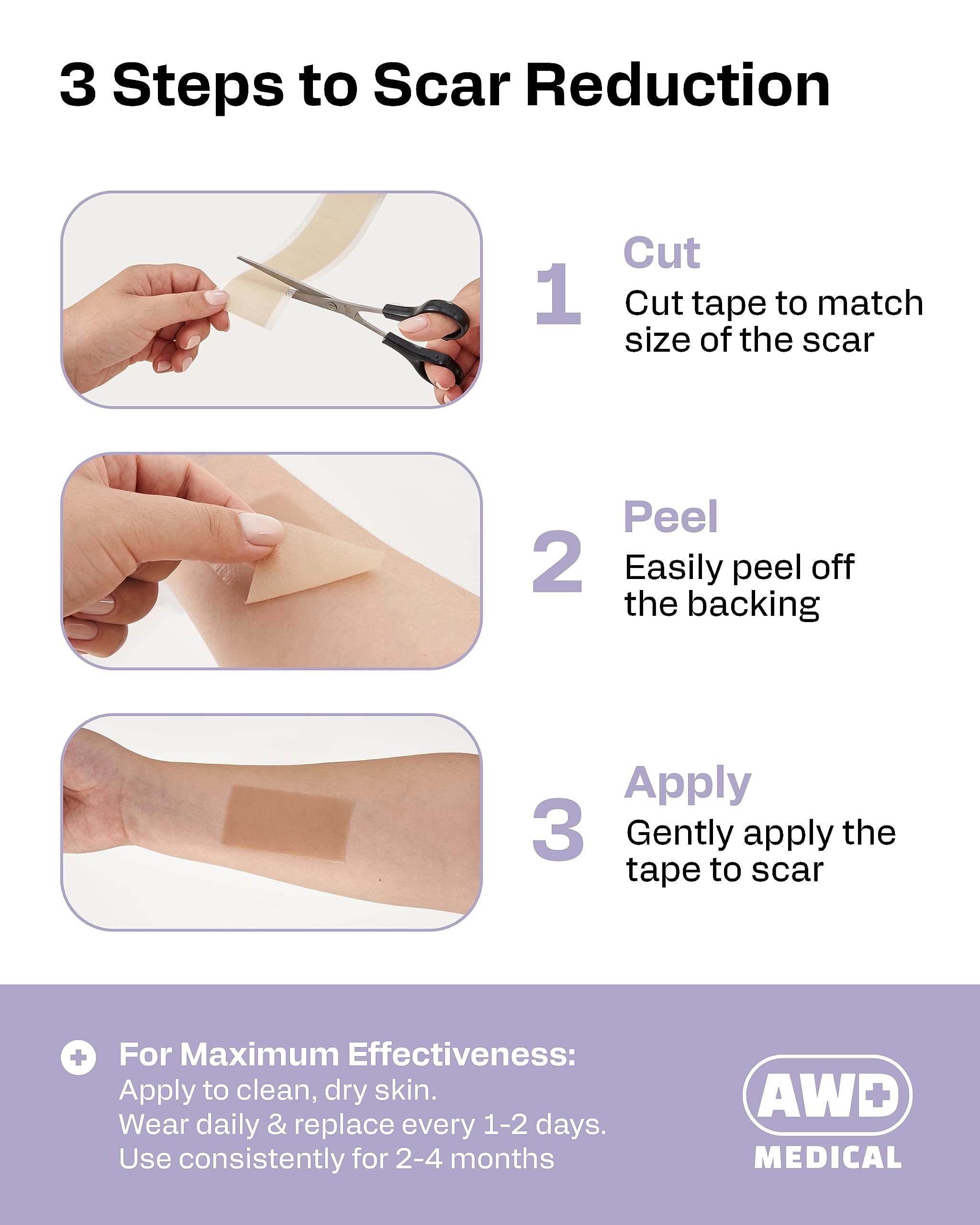 AWD Medical silicone scar tape on skin during application showing smooth adhesion
