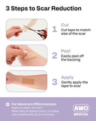 AWD Medical silicone scar tape on skin during application showing smooth adhesion