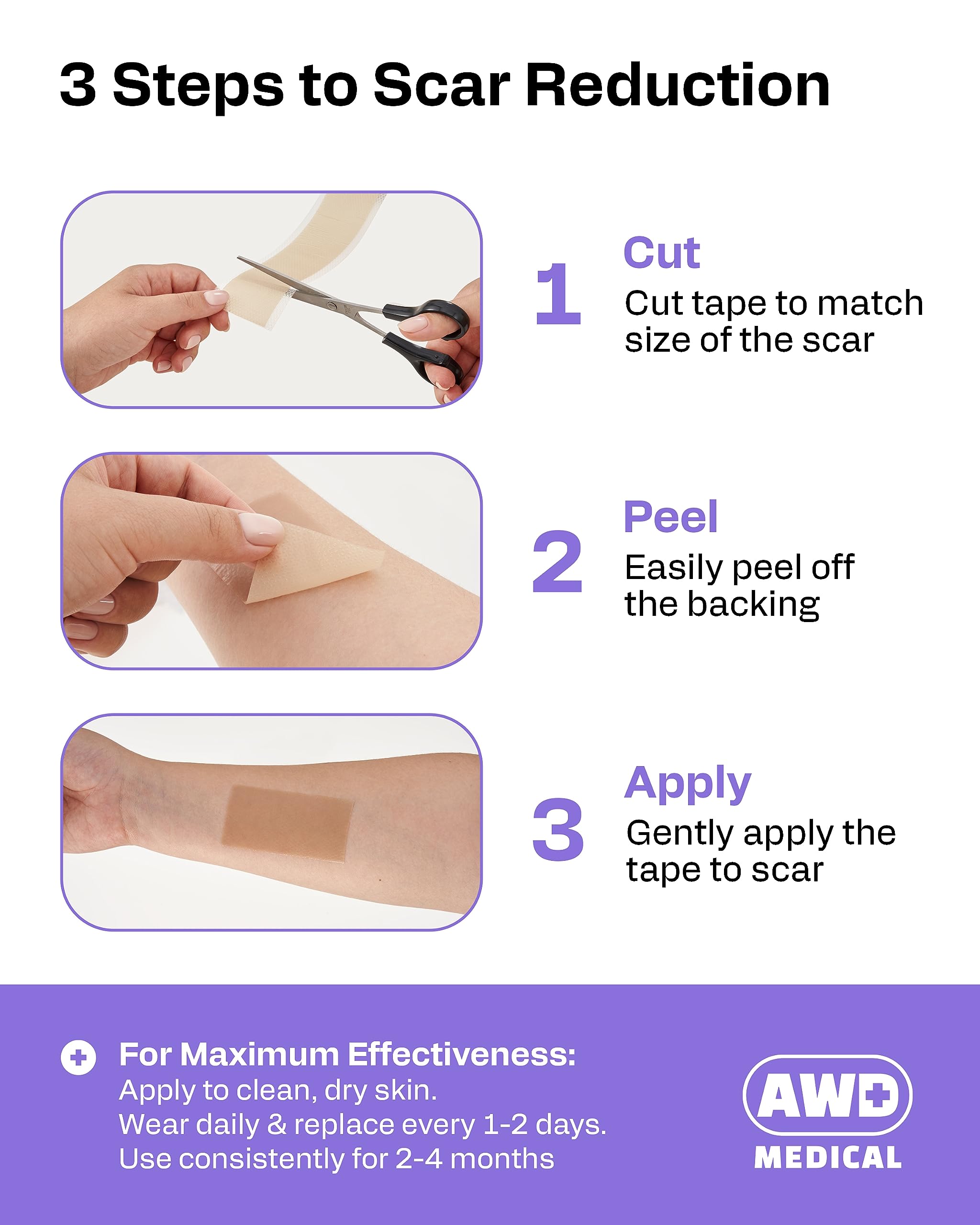 AWD Medical silicone scar tape on surgical scar – discreet protection