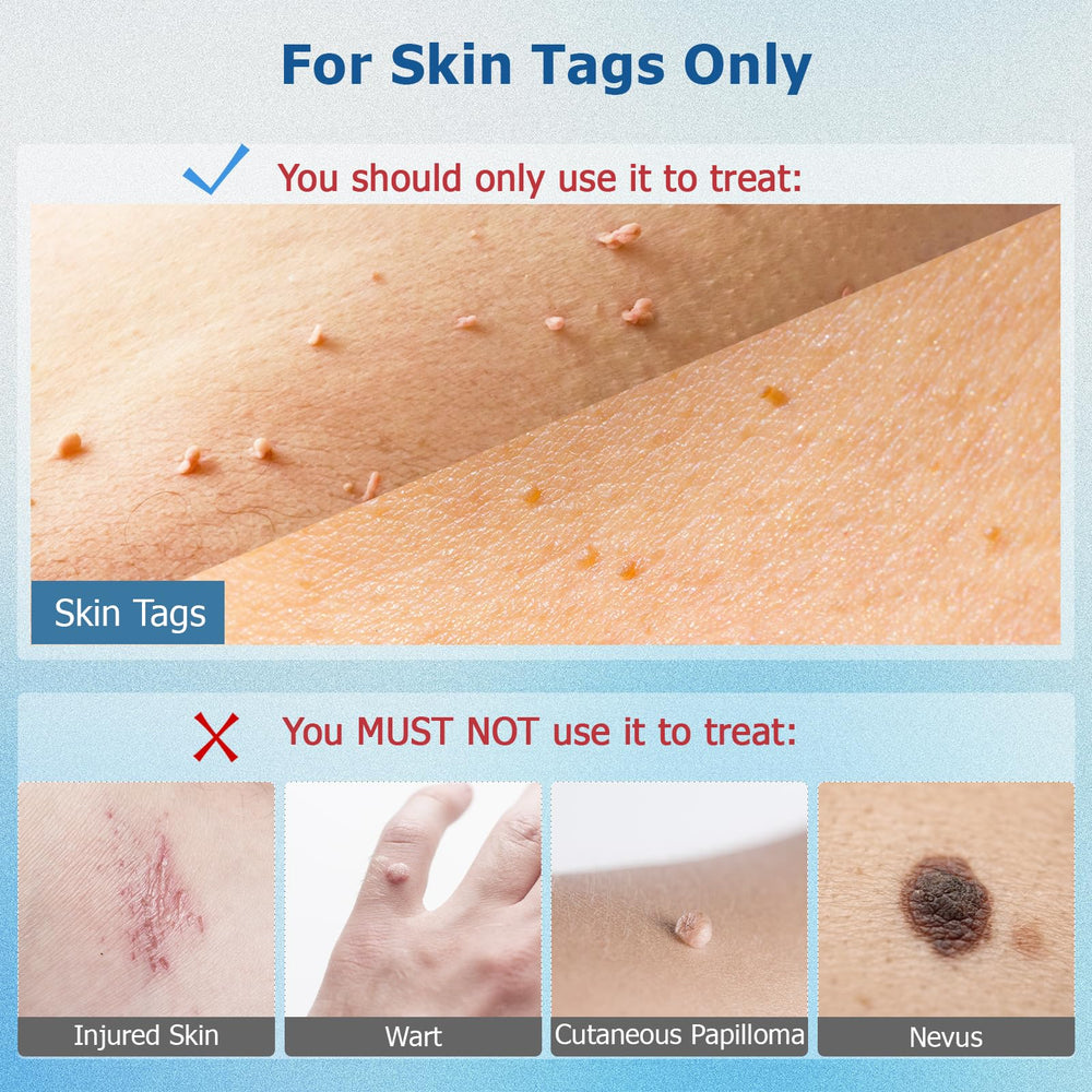 AWEKUU Skin Tag Remover secure lid to prevent leakage during storage