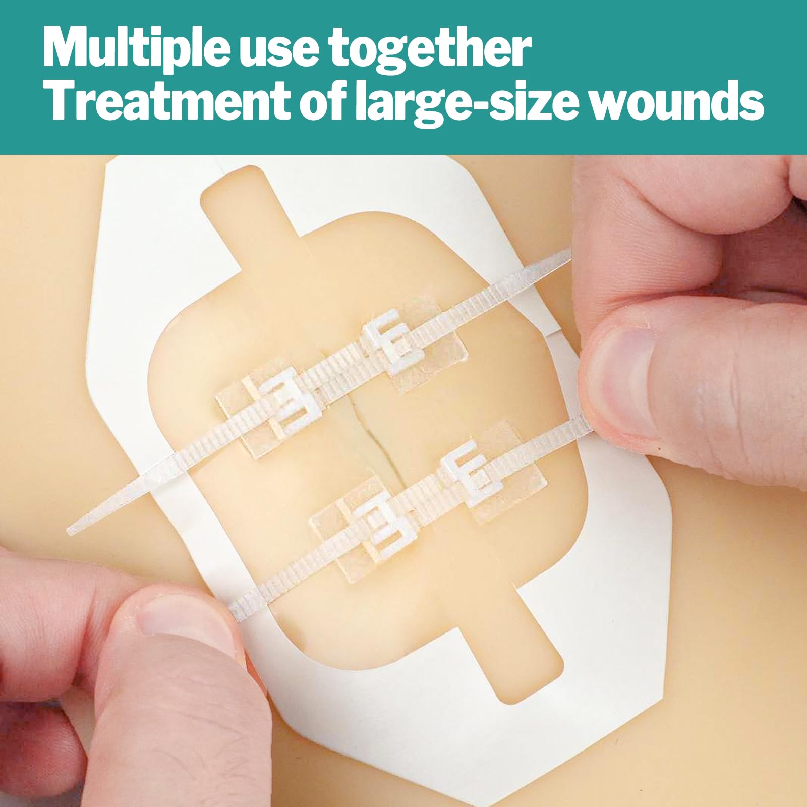 AZEN hypoallergenic bandage material close-up: strong, breathable adhesion