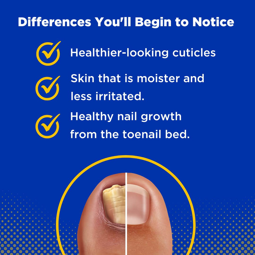 Nail bed renewal concept with Toelieva showing potential growth directions.