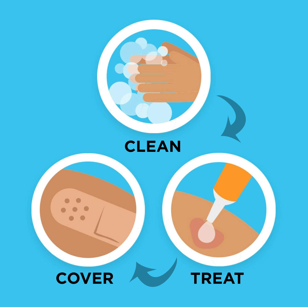 Band-Aid Water Block: vendajes transparentes que resisten el agua para uso diario.