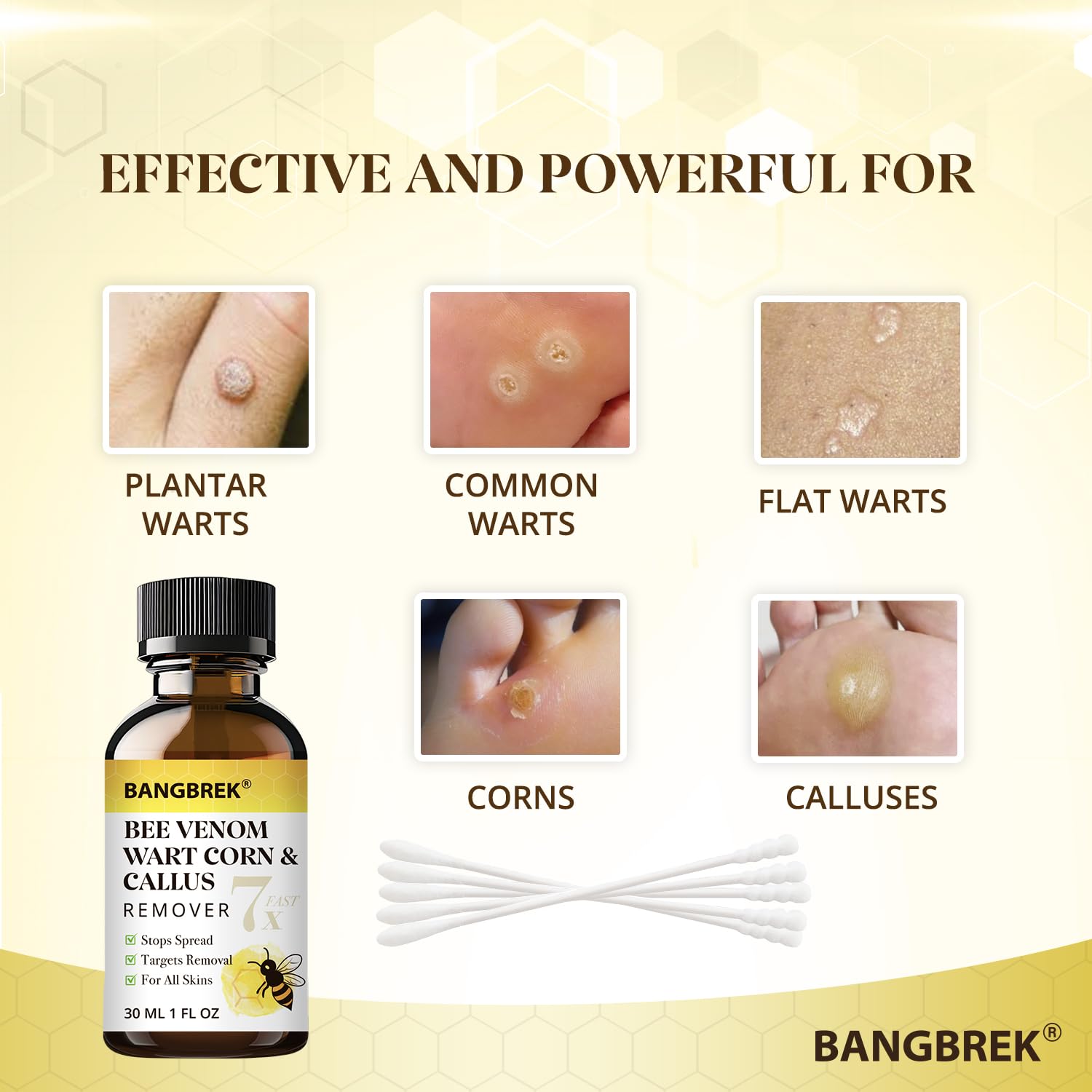 Close-up of toe applying Bangbrek Bee Venom Wart Remover for plantar wart care.