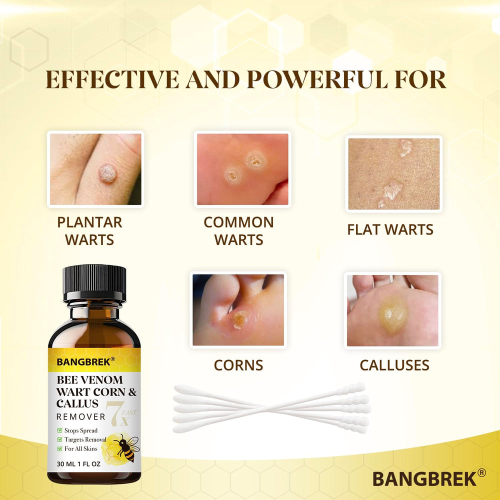 Close-up of toe applying Bangbrek Bee Venom Wart Remover for plantar wart care.