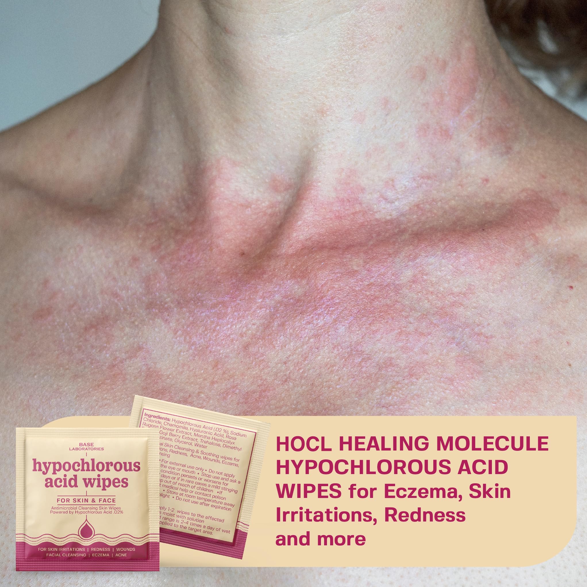 Base Laboratories individually wrapped HOCl wipes for convenient daily use.