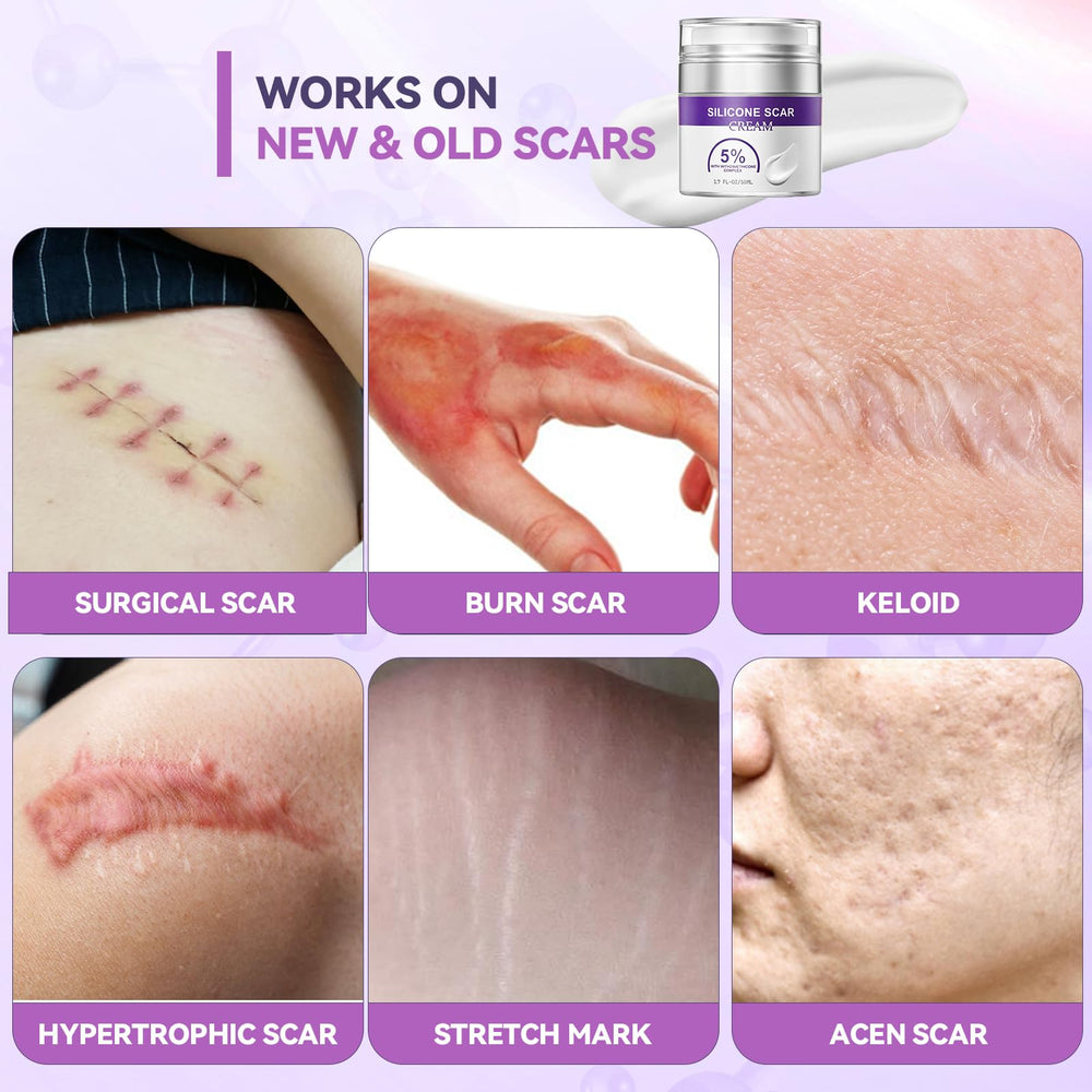 Lightweight texture of BAUTVAS Advanced Scar Cream for year round use