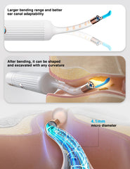 BEBIRD Earsight Plus adjustable-angle handle enables flexible, comfortable ear cleaning.