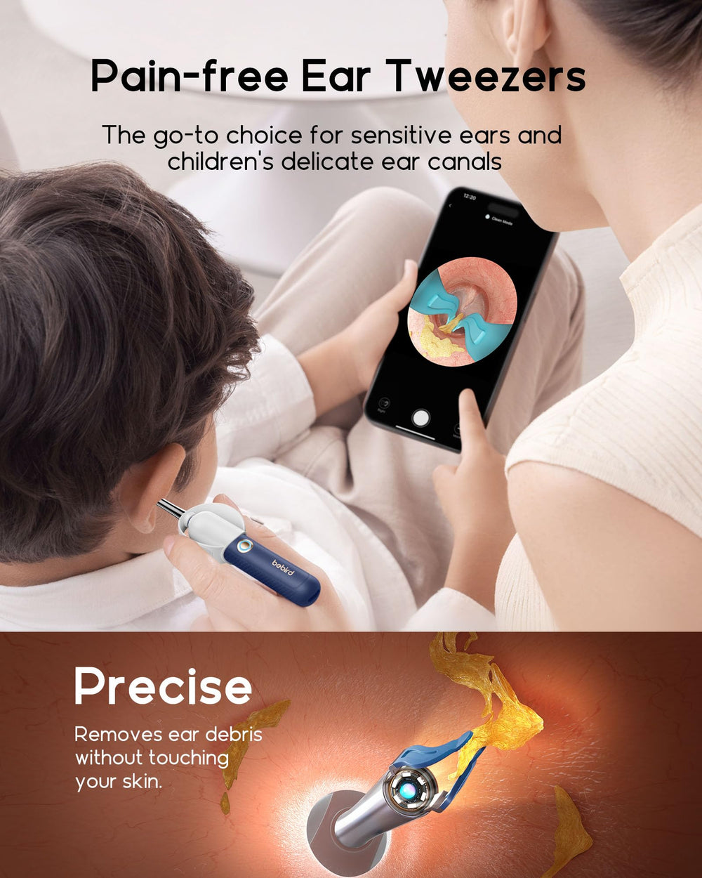 BEBIRD Earsight Plus camera-guided tweezers remove wax gently.