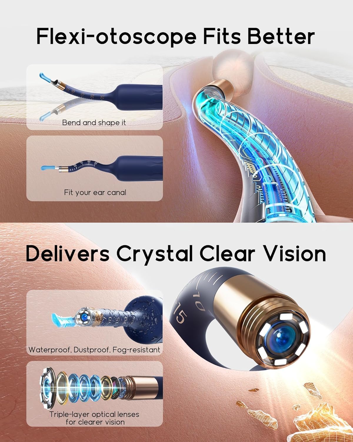 BEBIRD Earsight Plus D39R painless ear tweezers for gentle cleaning