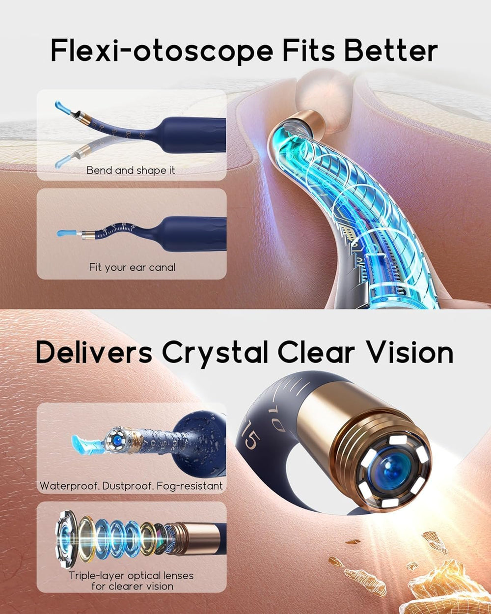 BEBIRD Earsight Plus D39R painless ear tweezers for gentle cleaning