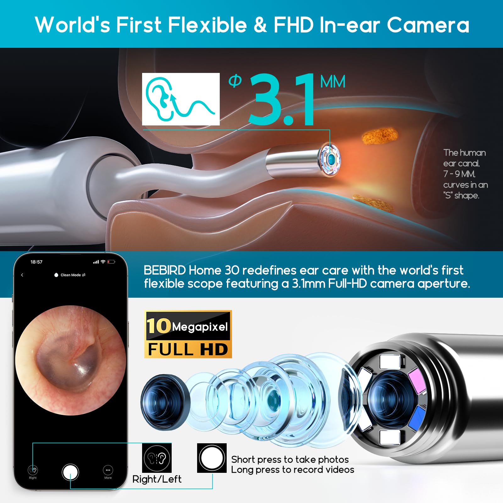 BEBIRD Home 30S high-res camera captures clear ear details for informed decisions