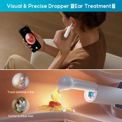 BEBIRD Home 30S visual ear-dropper guides accurate liquid placement safely