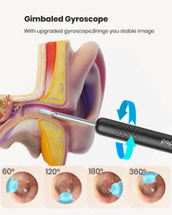 BEBIRD R1 multi-use-observation-kit supports ear, nose, and throat checks with comfort.