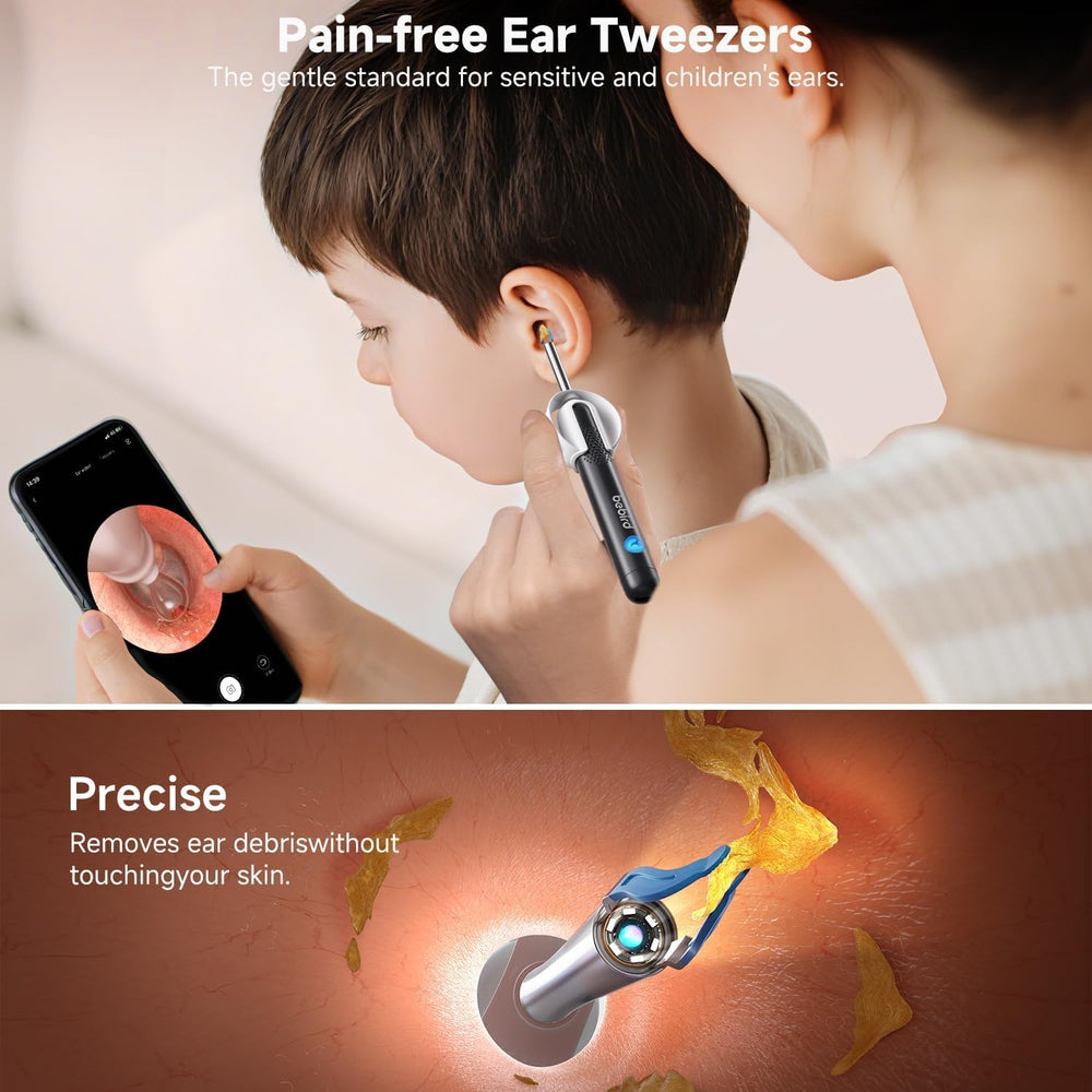 BEBIRD R1 Ultra ear tweezers for gentle debris removal