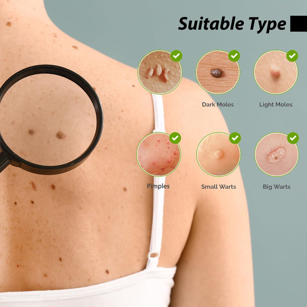 Befada wart remover serum spot application targets warts with precision.