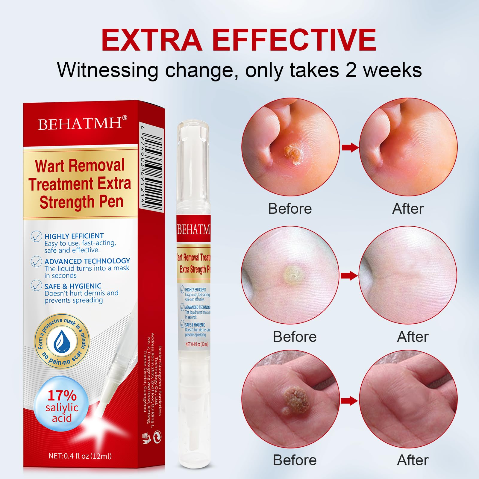 BEHATMH clean and dry skin prep enables quick, residue-free application.