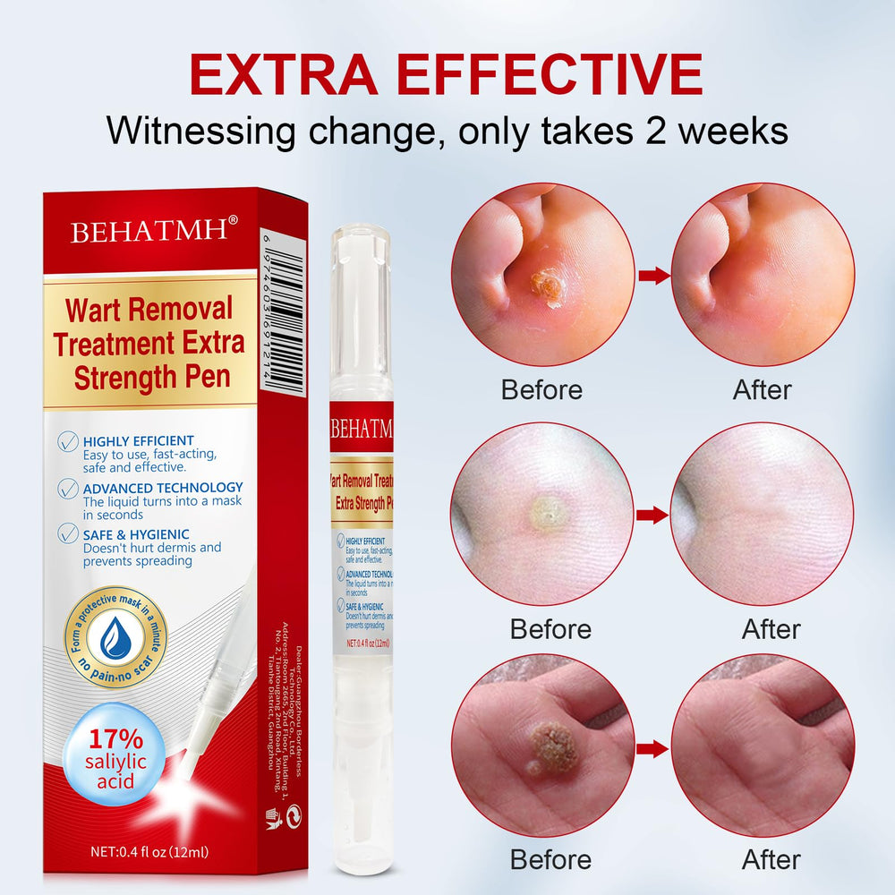 BEHATMH clean and dry skin prep enables quick, residue-free application.