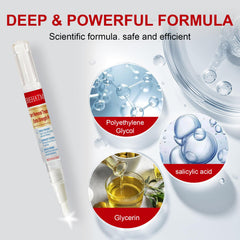 BEHATMH maximum-strength salicylic acid softens thick skin around the wart.