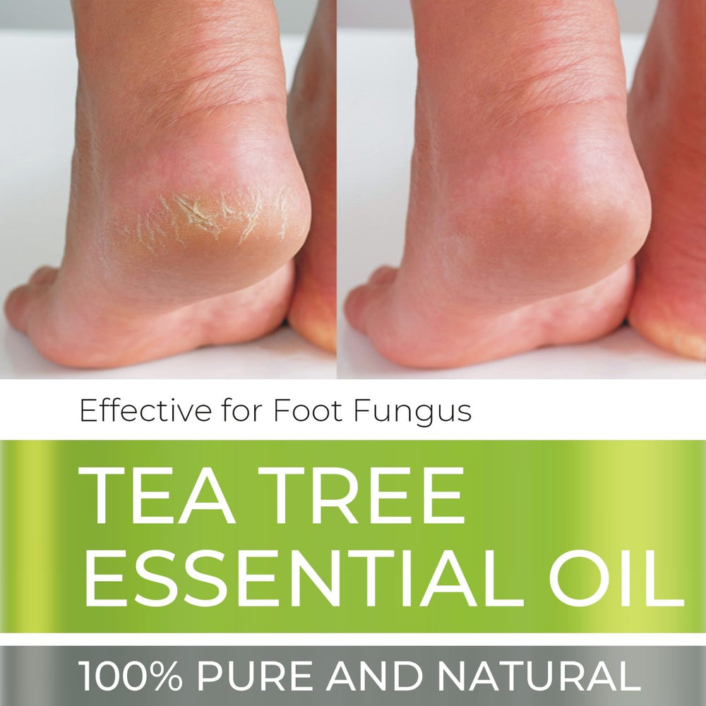 Being Naturals Tea Tree Oil in an aromatherapy diffuser for a refreshing ambiance.