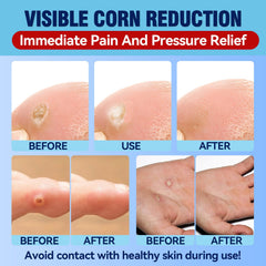 Bellemora callus remover pads absorb pressure for comfortable walking.