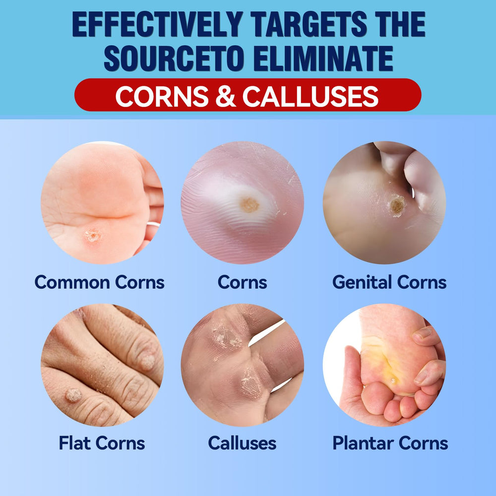 Bellemora corn remover foot patches provide discreet protection during daily activities.